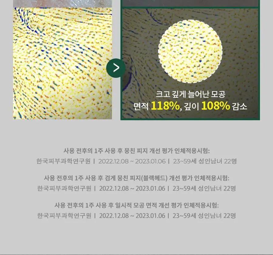 [증정 기획] 닥터지 레드 블레미쉬 포 맨 올인원 오일컷 로션 150ml 기획 (+30ml) 상세페이지 17